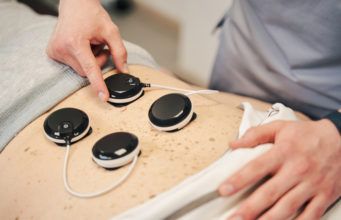 Neuromuskuläre Elektrostimulation in der Physiotherapie: Revolution oder Hype?