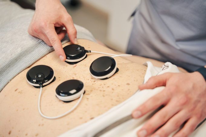 Neuromuskuläre Elektrostimulation in der Physiotherapie: Revolution oder Hype?